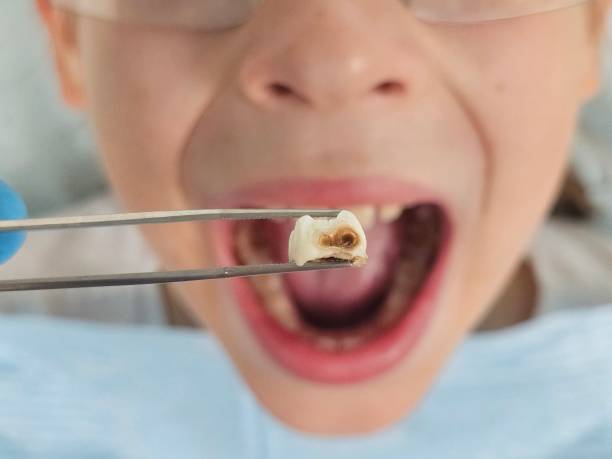 Best Walk-In Emergency Dentist in Boston, GA