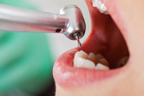 Best After-Hours Emergency Dentist in Boston, GA